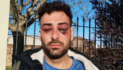 Un profesor de música de La Plata denunció una golpiza y torturas de la Policía: "Pensé que me mataban"
